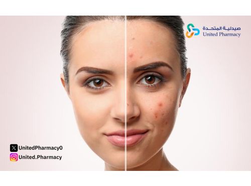 كريم فيوسيدين لآثار الحبوب