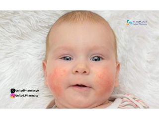 هل كريم فيوسيدين مناسب للاطفال