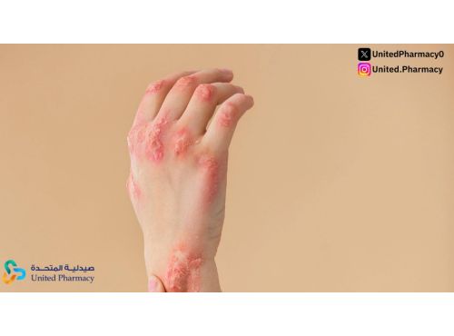 هل الاكزيما معدية؟ أهم المعلومات التي يجب معرفتها