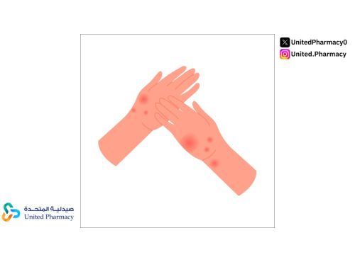 تعرف على اسباب حكة الجسم بدون طفح جلدي وكيفية علاجها