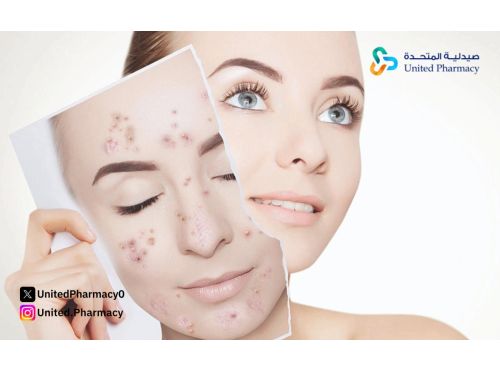 كريم فيوسيدين للوجه