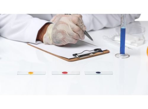 ما هو فحص mchc؟ وما أهميته