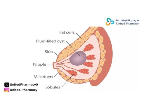 الكيس الدهني في الثدي
