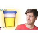 اسباب رائحة البول القوية