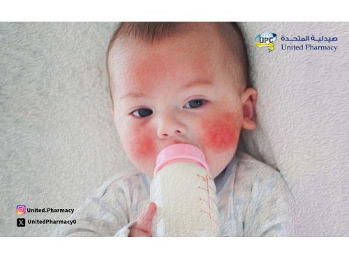 اعراض حساسية الحليب للرضع