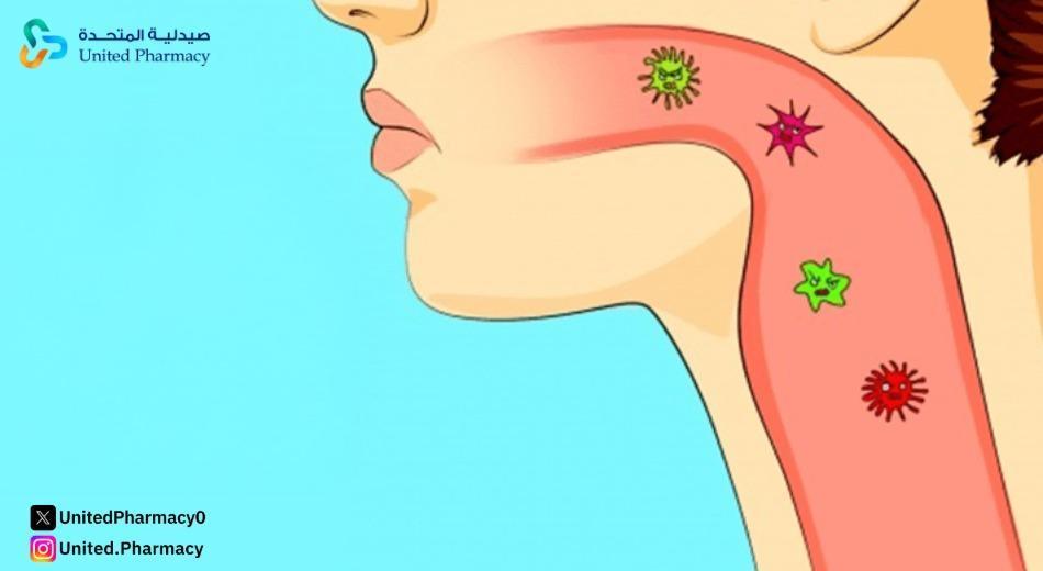  التهاب الحلق