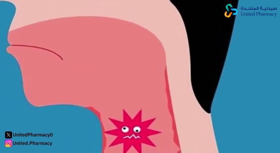 أعراض الْتهاب الحلق