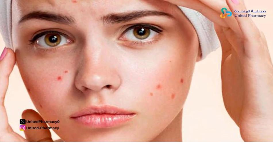 فوائد جل ديفرين