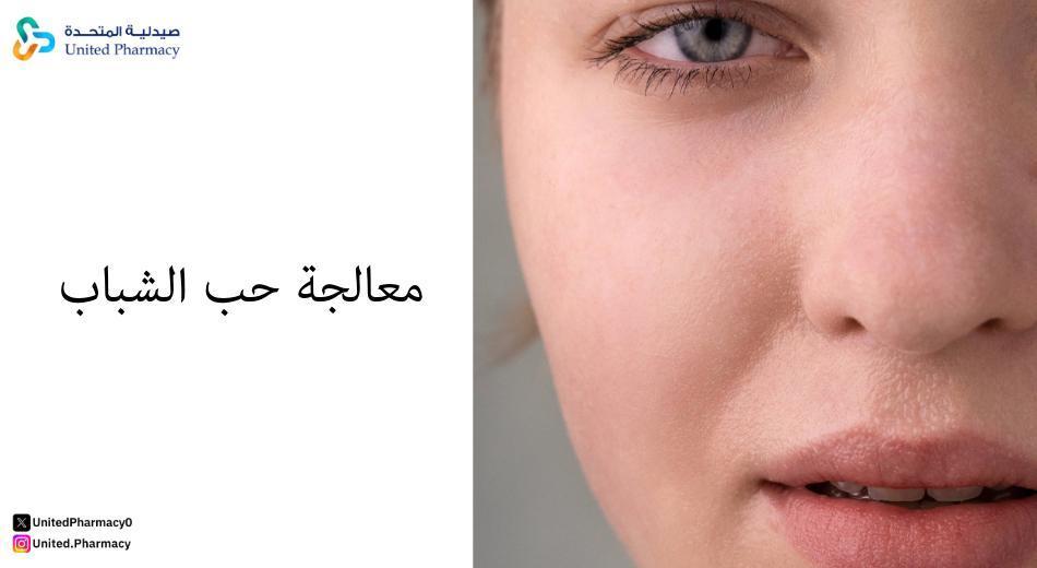 كيف أزيل حب الشباب والرؤوس السوداء في المنزل؟