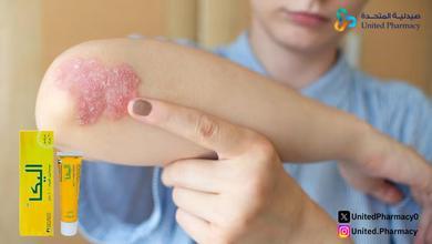 كريم اليكا للتصبغات كريم اليكا للتصبغات