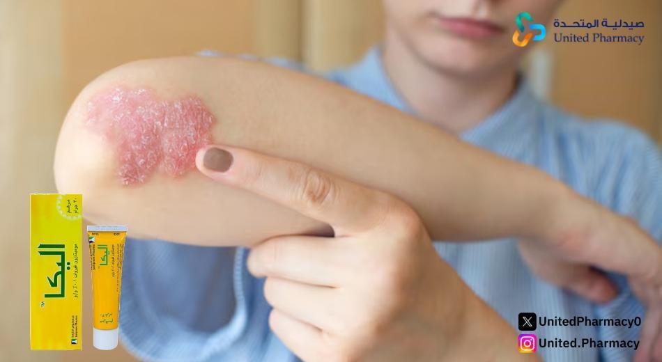 كريم اليكا للتصبغات كريم اليكا للتصبغات