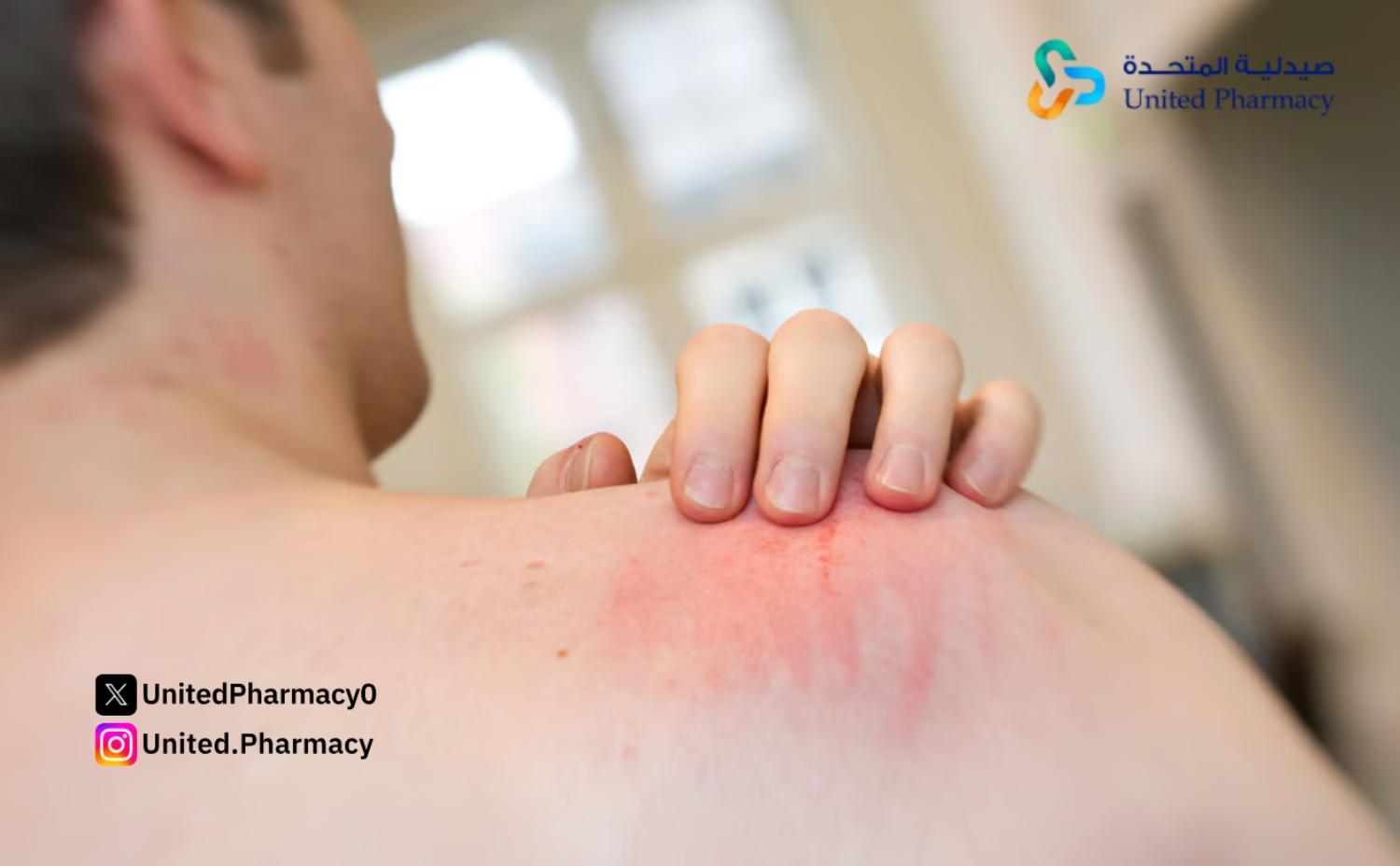 فيوسيدين الأحمر لعلاج الالتهابات