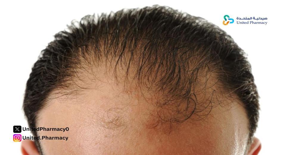 شامبو لمنع تساقط الشعر للرجال