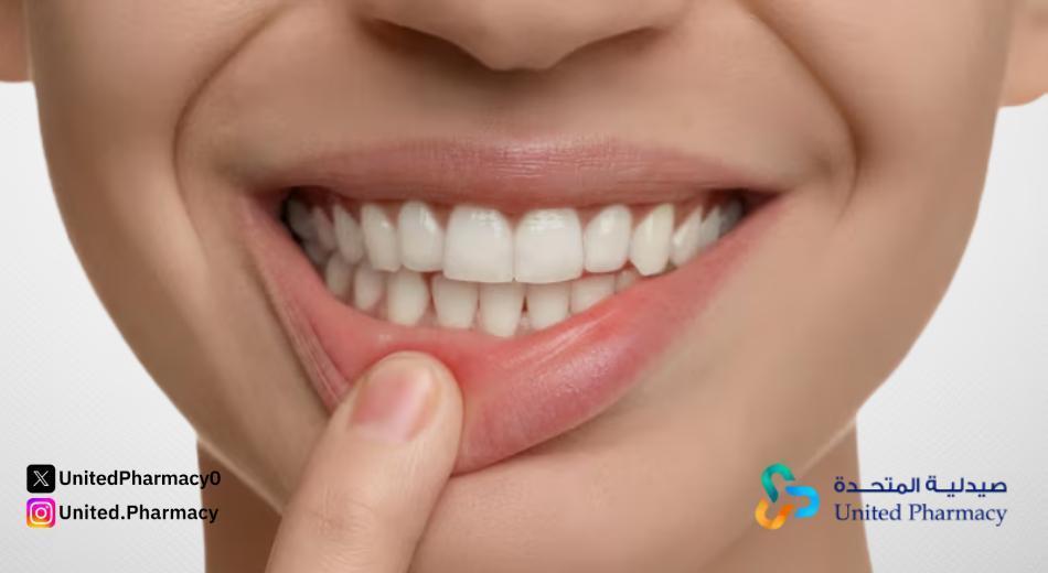 علاج التهاب اللثة سريع المفعول