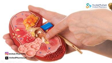 ما هي فائدة حبوب روانكس ما هي فائدة حبوب روانكس